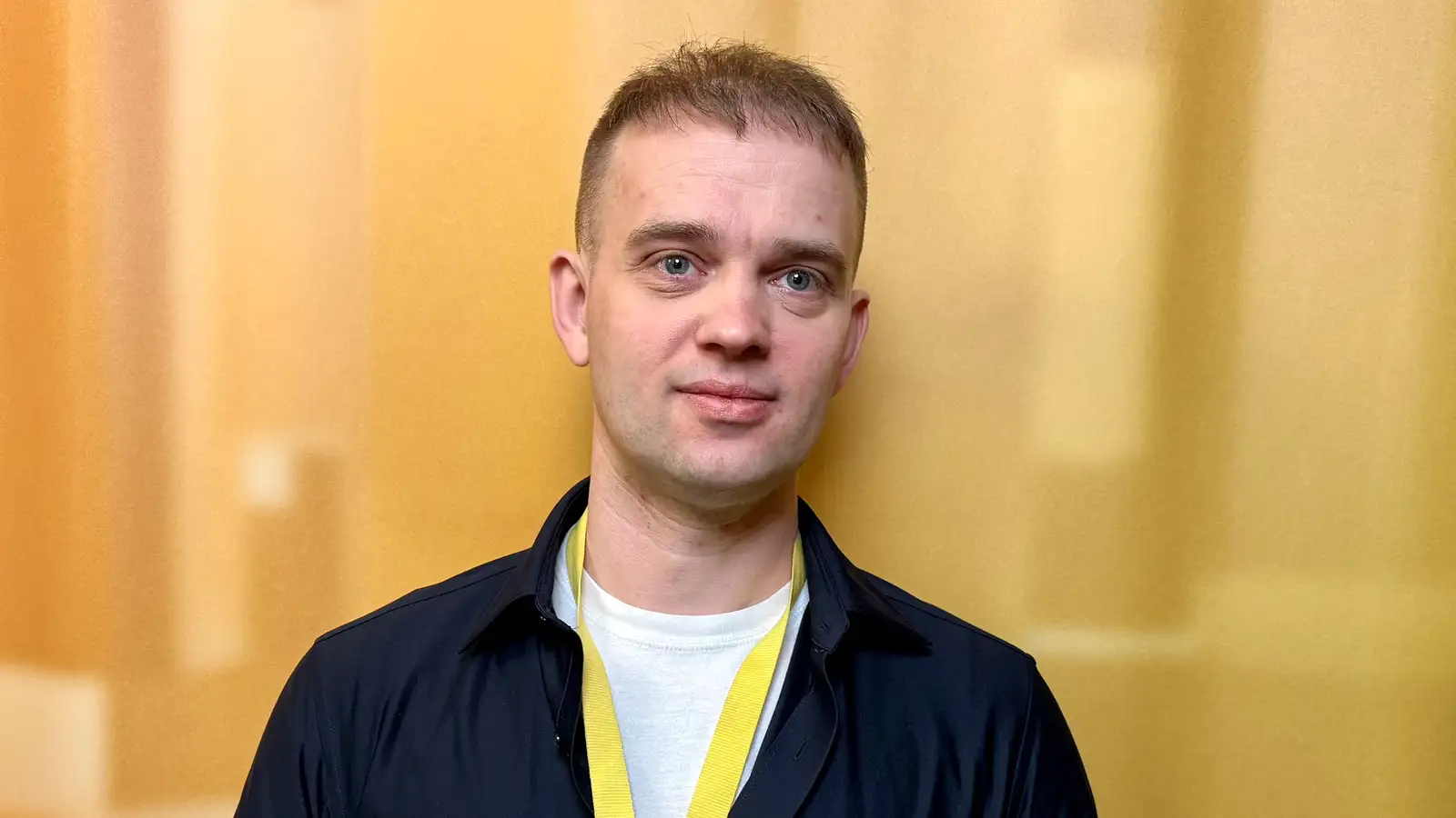 Sjálfstraustið sneri aftur eftir hárígræðsluna