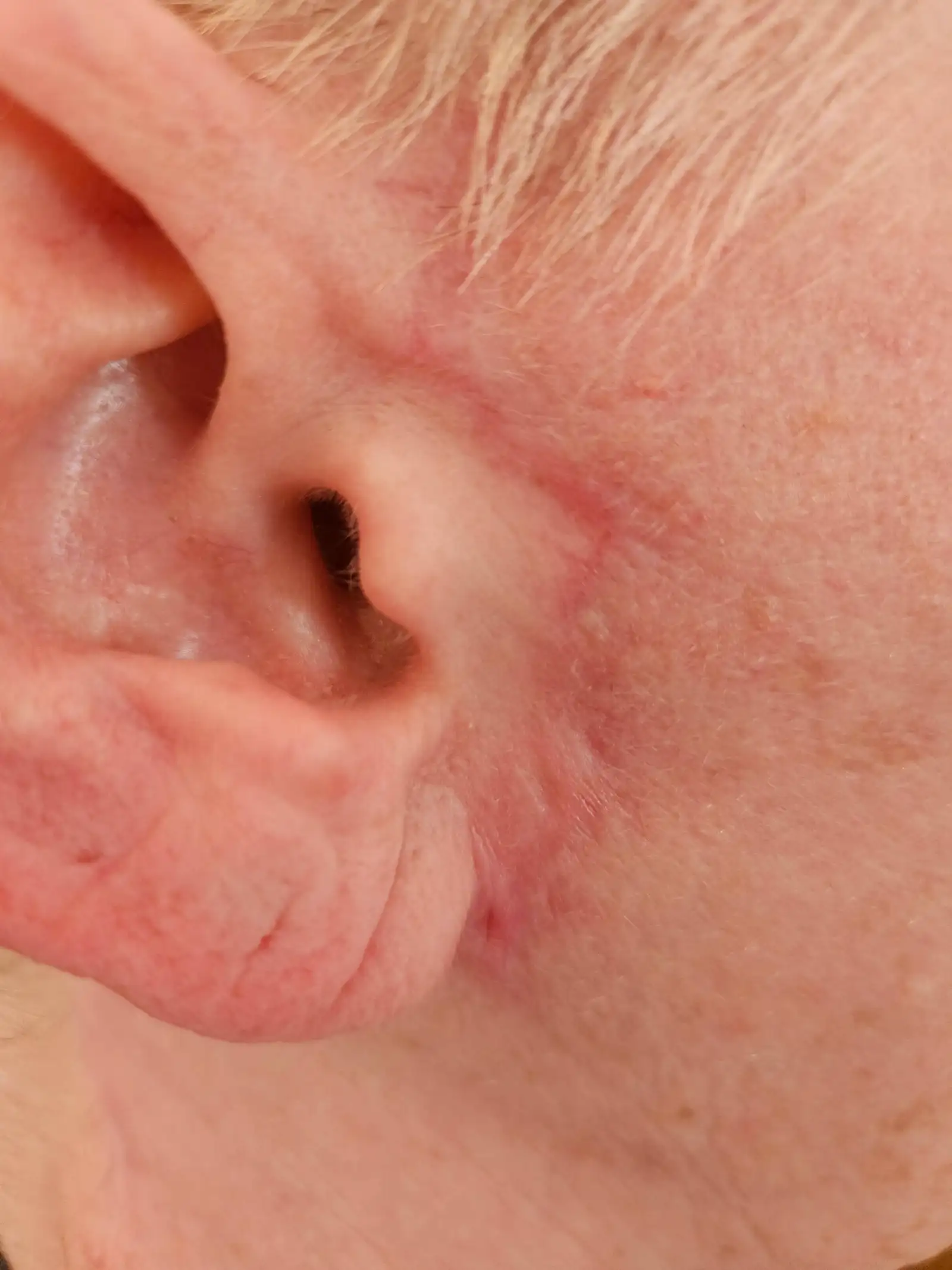 Örin á konunni voru áberandi eftir aðgerðina